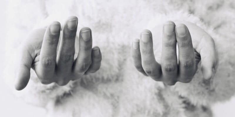 صورة لـ تطبيق جديد للهاتف الذكي سيكشف فقر الدم من خلال أظافرك فقط | news-anemia-fingernails-featured-DzTechs
